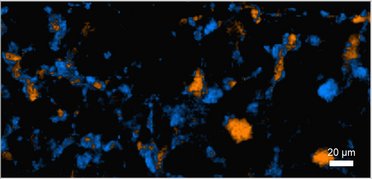 Polymorphisms characterization: when Raman microscopy supports the pharmaceutical industry
