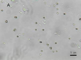 Raman Investigation of Micro-organisms on a single cell level